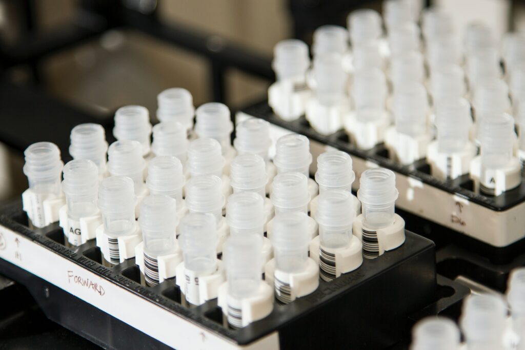Ein Tablett voller Proben im Labor.